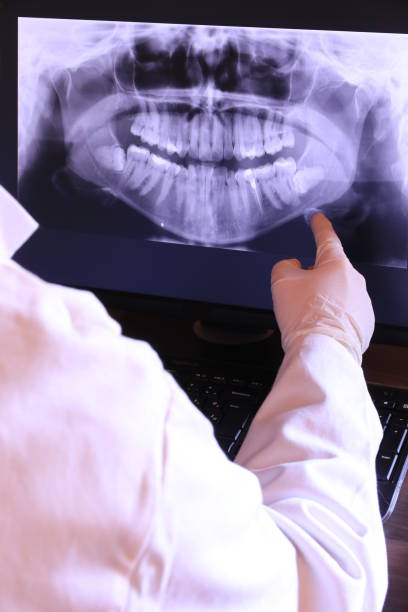 Best Urgent Care for Lost Fillings or Crowns in Rossmoor, NJ
